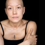 Facing Chemo, a photographic project
